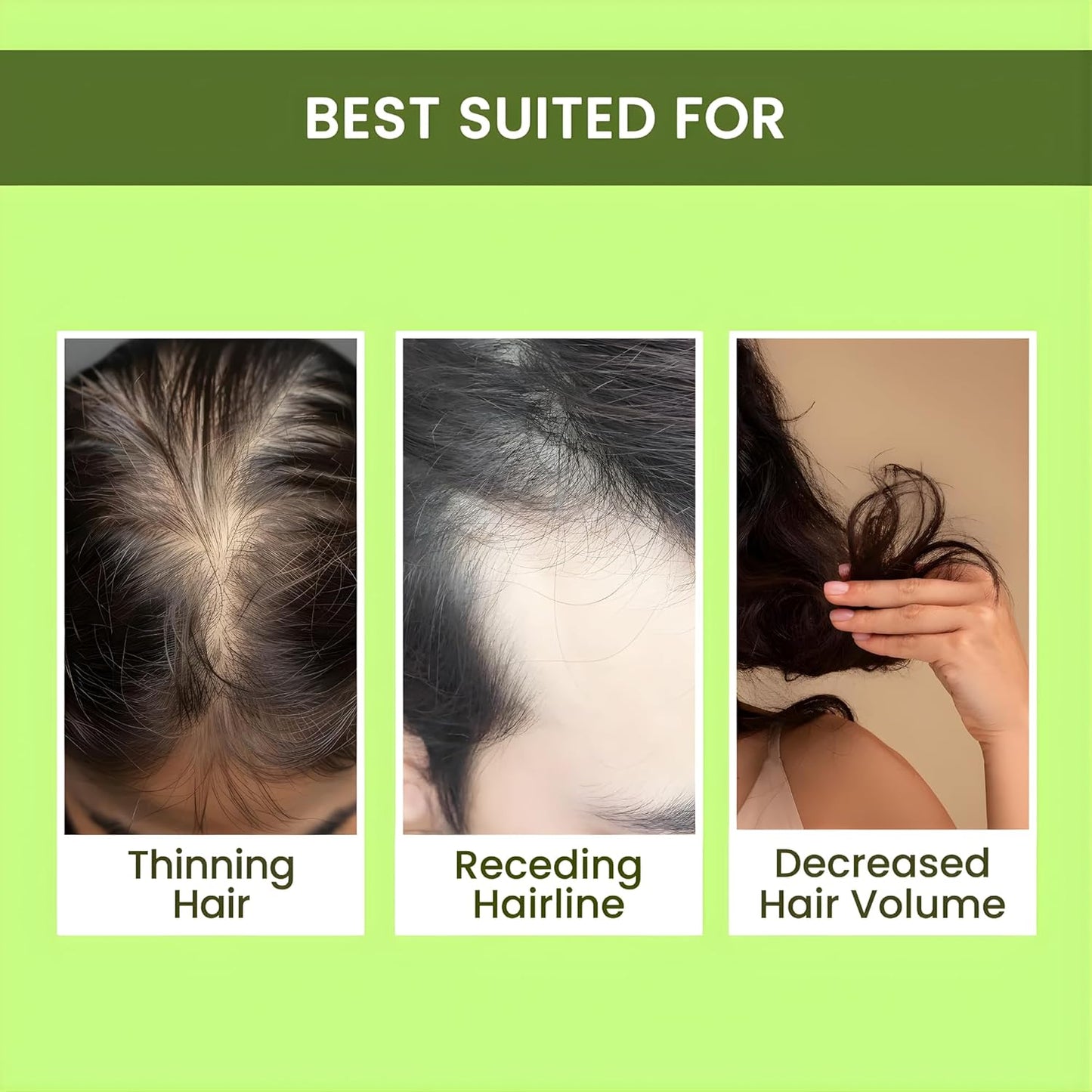 Rosemary Water | Hair Growth Expert | Rosemary Water For Hair | Hair Spray for Regrowth